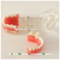 China Medical Anatomical Model Removable Soft Gingiva Standard Dental Jaw Model 13017